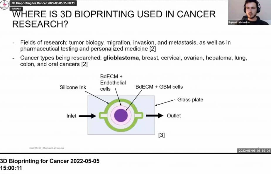 breast cancer bioprinting modeling