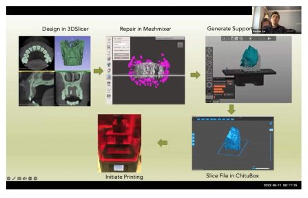 Dental 3D Printing - The Ultimate Guide - 3DHeals